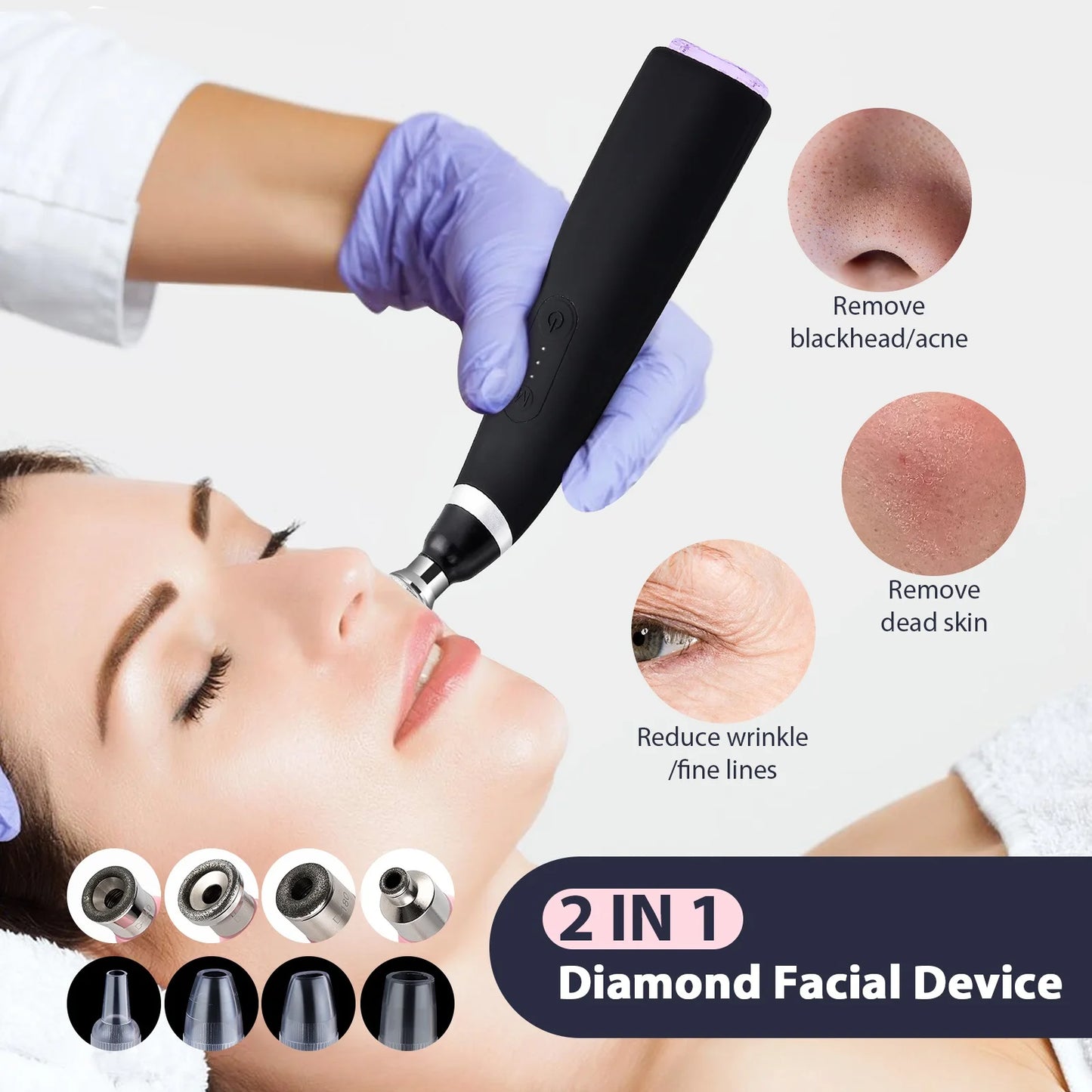 Portable Vacuum Blackhead Remover