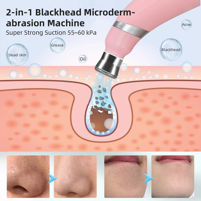 Portable Vacuum Blackhead Remover