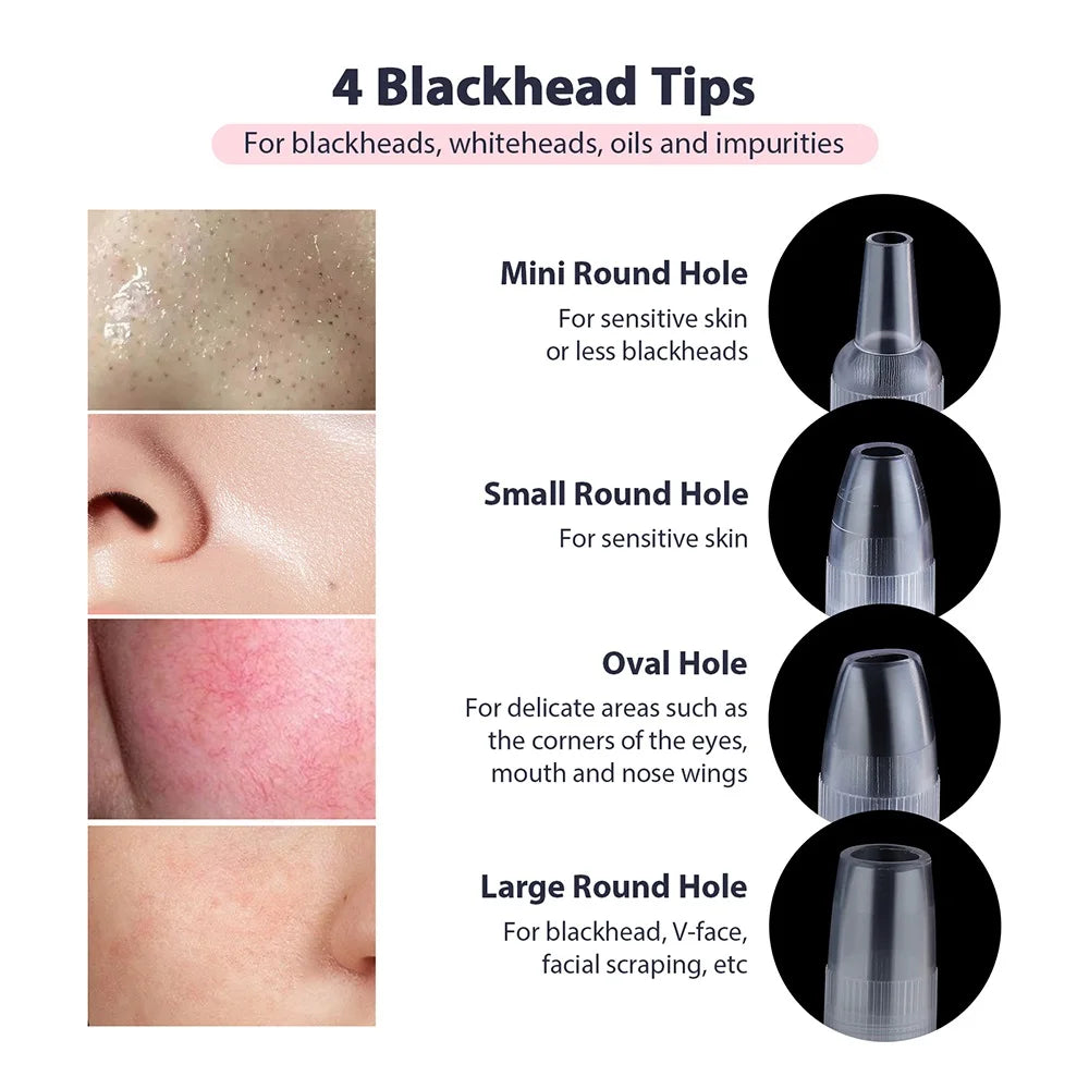 Portable Vacuum Blackhead Remover